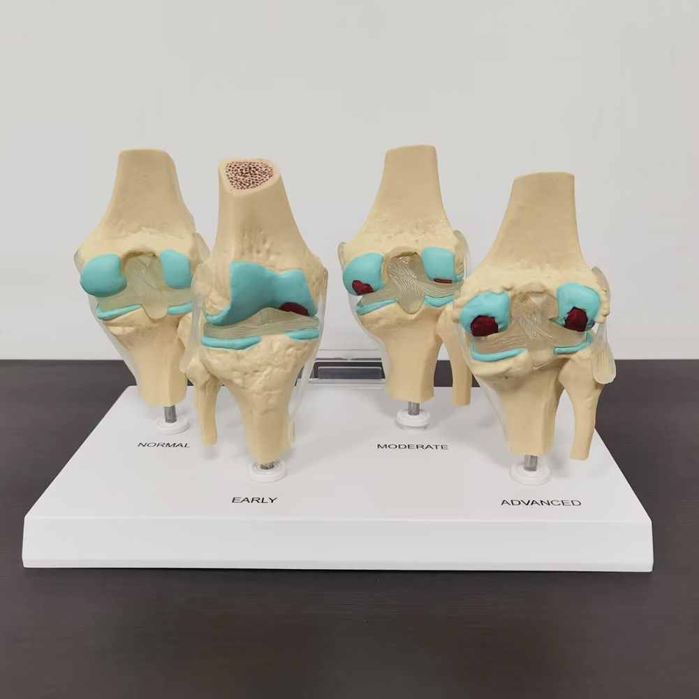4-stage knee joint model Plast - Medical Lab Assistant 评论和价格