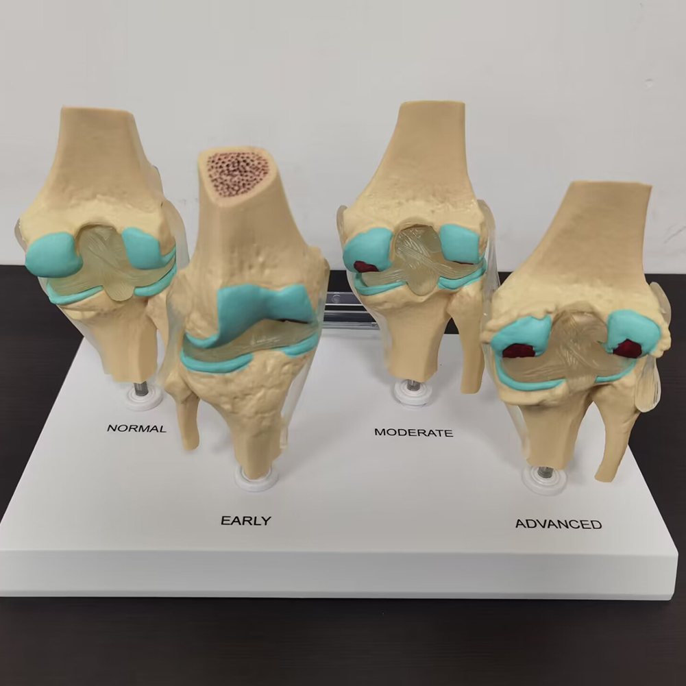 4-stage knee joint model Plast - Medical Lab Assistant 评论和价格