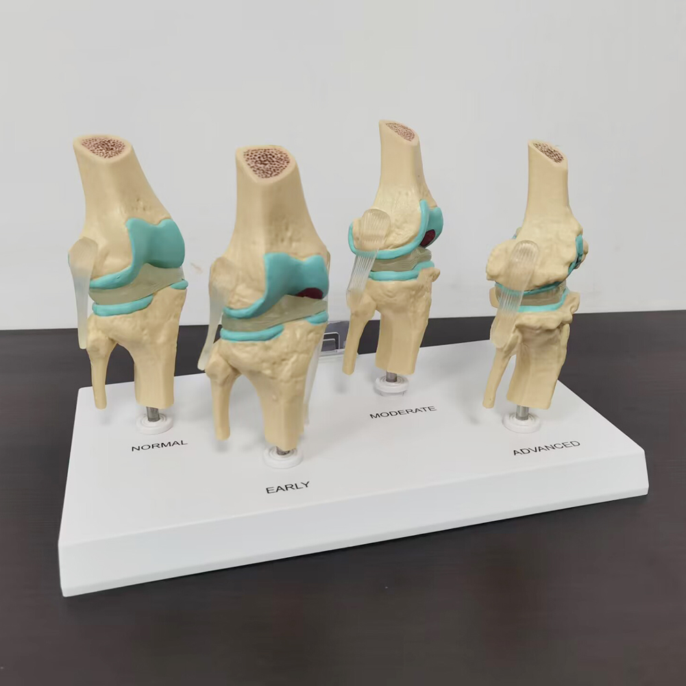 4-stage knee joint model Plast - Medical Lab Assistant 评论和价格